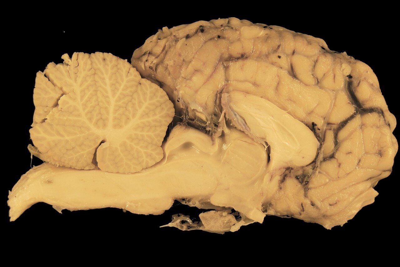 Advanced neuroimaging technology is showcased in a lab, highlighting the realtime observation of brain activity linked to bodily sensations