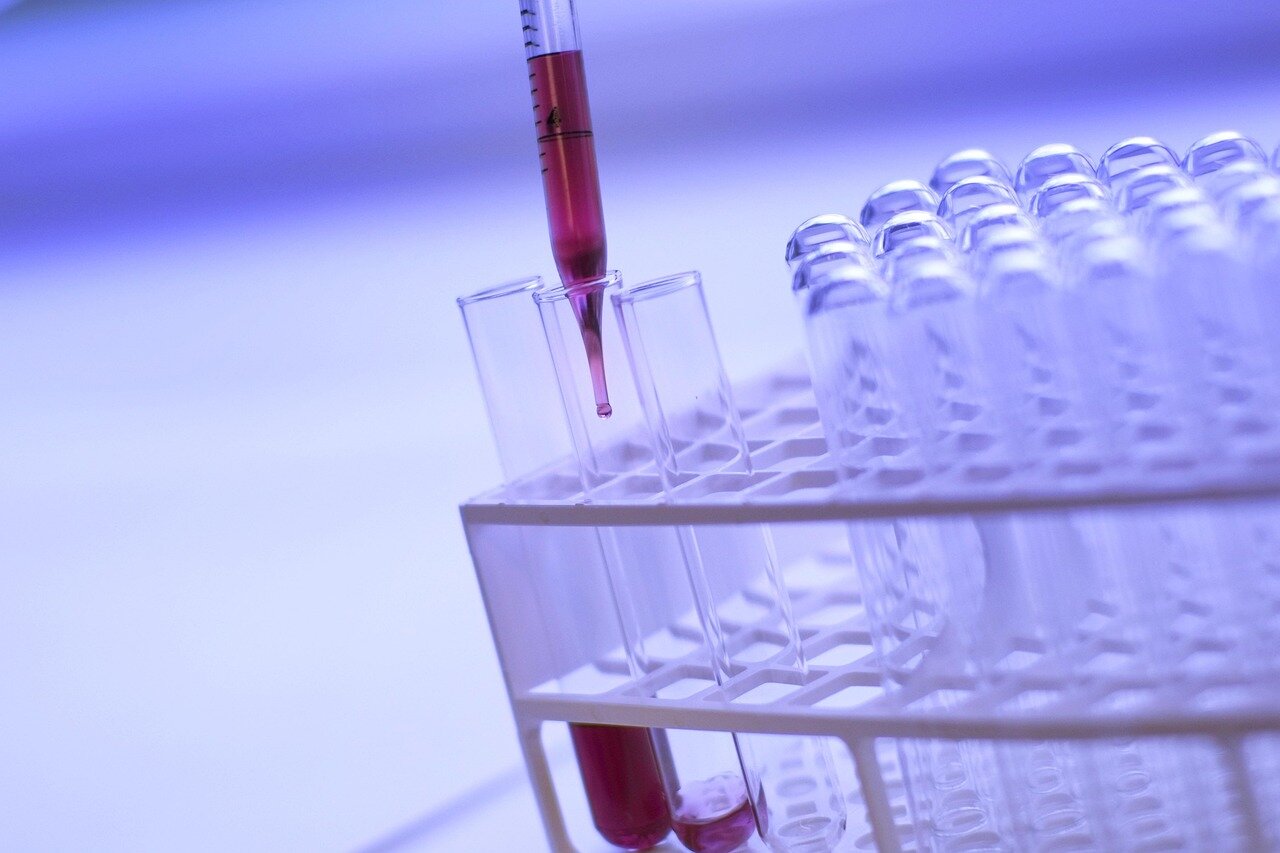 A group of men in a healthcare setting discusses prostate cancer screening options with a medical professional, highlighting the recent changes in guidelines for highrisk individuals.